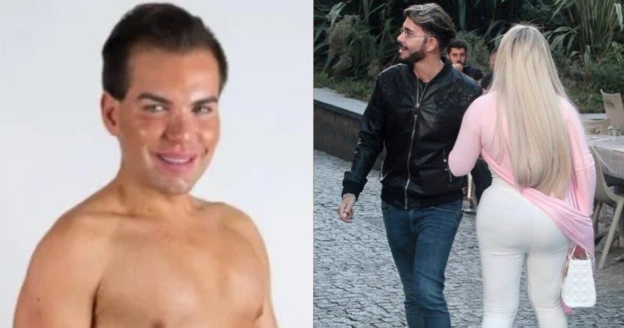 Άντρας έκανε 103 πλαστικές, έγινε γυναίκα, έχασε την όσφρυσή της και σήμερα μοιάζει με κούκλα από ταινία… τρόμου