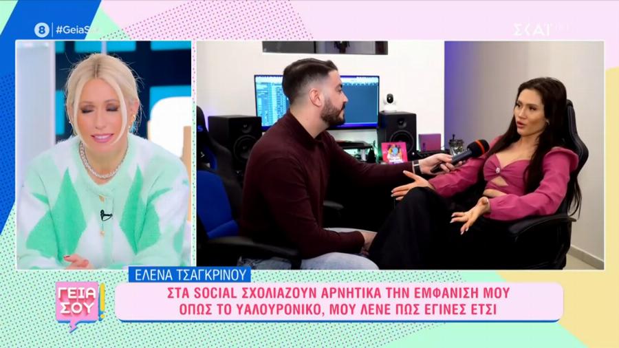 «Πώς έγινες έτσι;»: Το νέο πρόσωπο της Έλενας Τσαγκρινού, τα αρνητικά σχόλια για τις αισθητικές παρεμβάσεις και η απάντηση