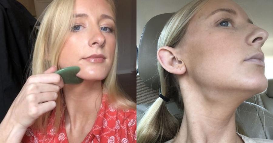 Ανακάλυψε κατά τύχη πως έχει όγκο στο λαιμό: Η 26χρονη Ελένη βρήκε ότι έχει καρκίνο μέσα από ένα βίντεο στο Tik Τok