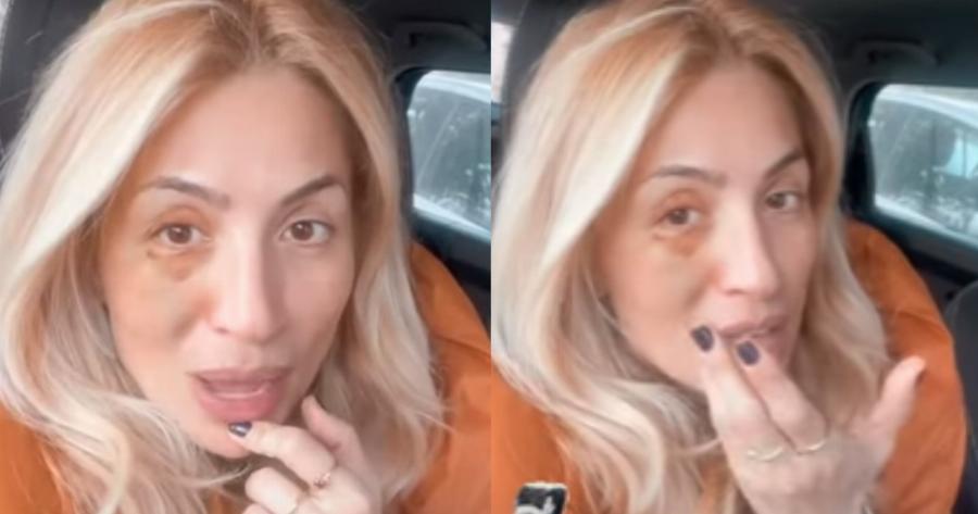 Με μελανιασμένο μάτι η Μαρία Ηλιάκη: «Δεν μεγαλώνω παιδί» λέει για το περιστατικό που συνέβη με την κόρη της