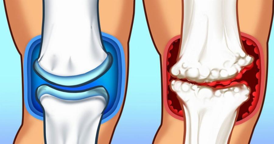 Το ρόφημα που υπάρχει σε κάθε νοικοκυριό και χτίζει γερά οστά: Κι όμως δεν είναι αυτό που φαντάζεστε!