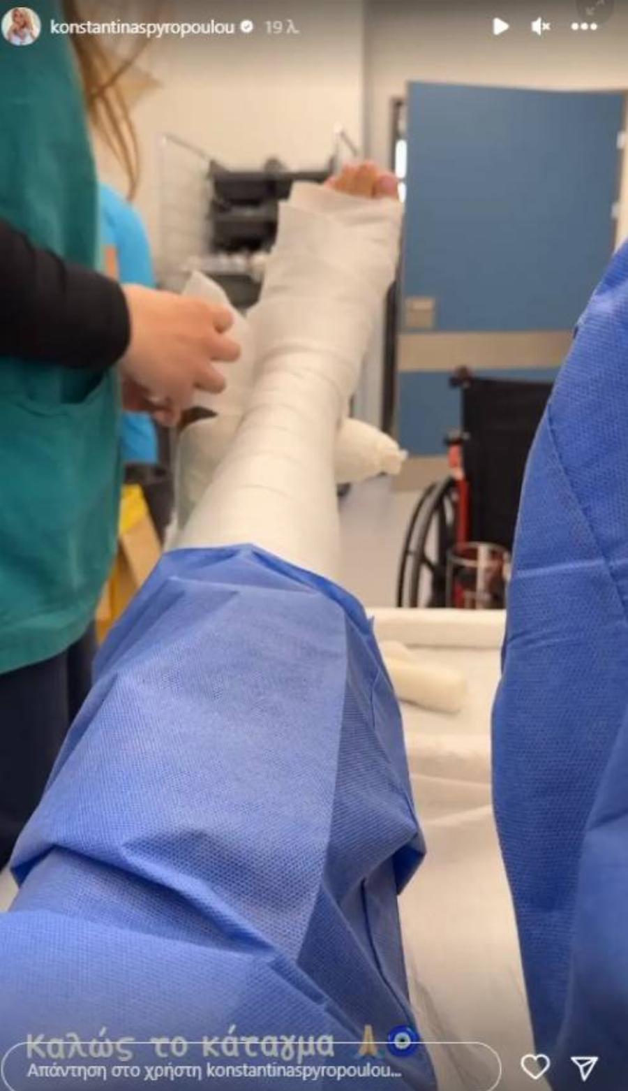 Πολύ δύσκολες ώρες για την Κωνσταντίνα Σπυροπούλου: Κυκλοφορεί με πατερίτσες μετά το ατύχημα, το δημόσιο μήνυμα