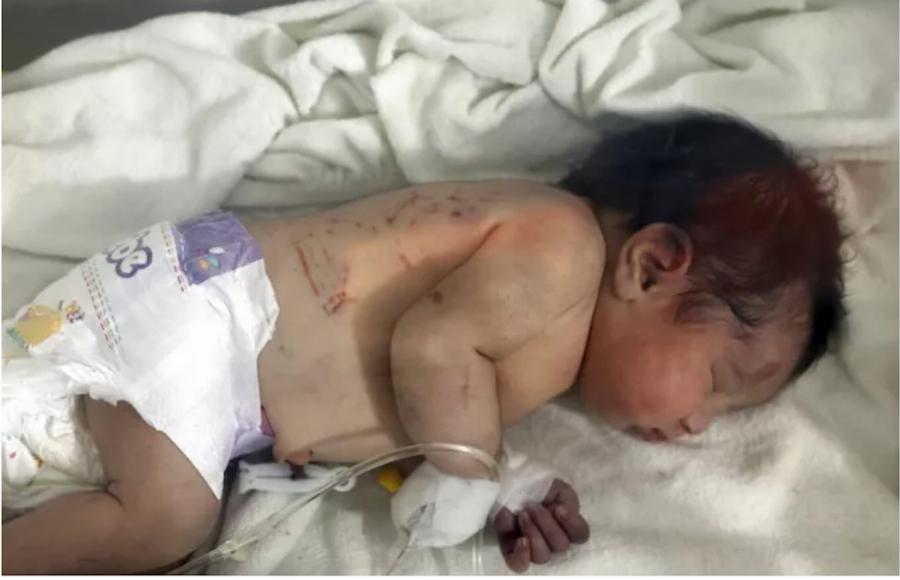 Σημάδι από το Θεό: Το μωρό που γεννήθηκε στα χαλάσματα έχει πλέον οικογένεια – Το συμβολικό όνομα που του έδωσαν