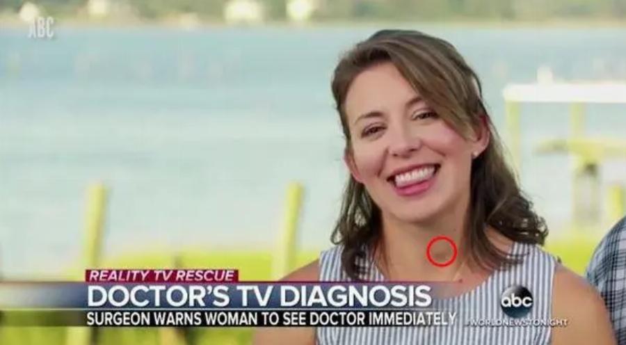 «Παρατήρησα ότι είχε ένα εξόγκωμα στον λαιμό της»: Εμφανίστηκε στη τηλεόραση, ένας γιατρός της βρήκε καρκίνο και της έσωσε τη ζωή