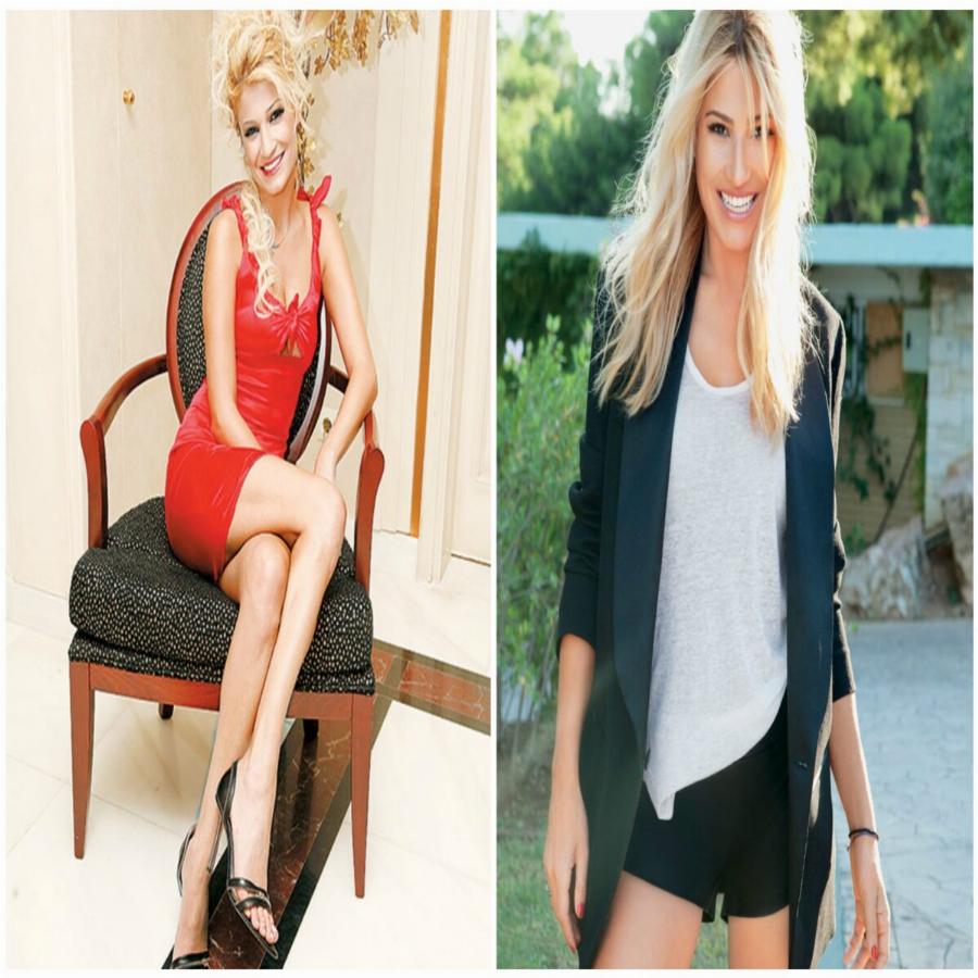 Κανείς δεν θα τις αναγνώριζε: Πως ήταν 15 διάσημες Ελληνίδες στα πρώτα βήματα της καριέρας τους