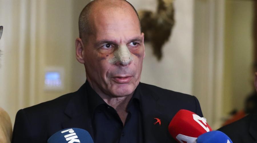 Όλο το Ίντερνετ μιλάει για αυτό: Xαμός με την ομοιότητα του Βαρουφάκη με τον Βόλντεμορτ από το Χάρι Πότερ