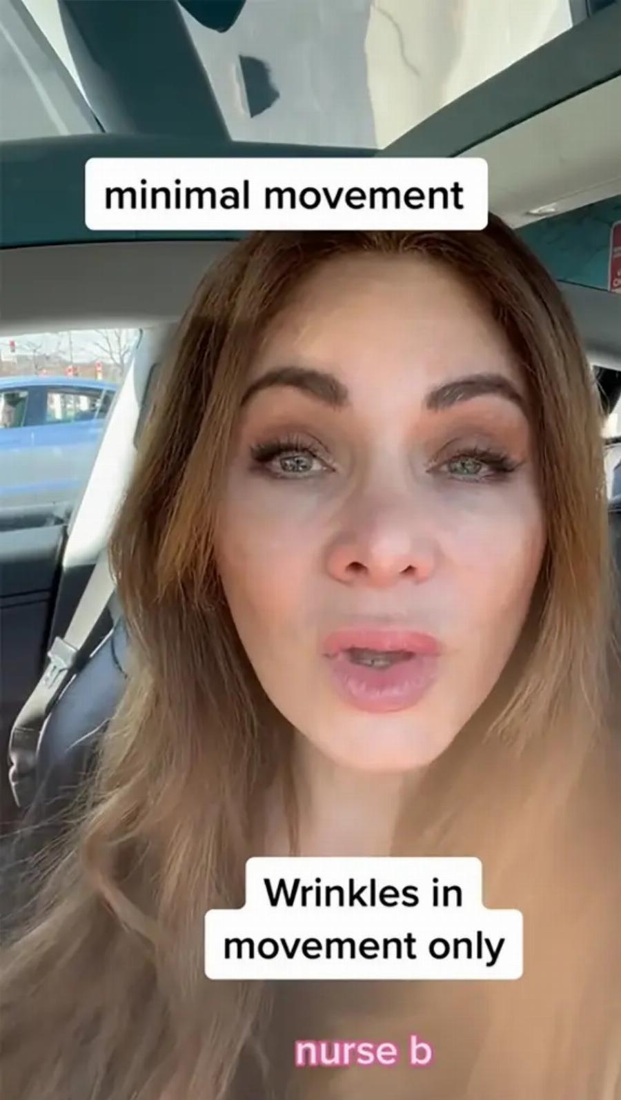 «Πάγωσαν» οι ακόλουθοι με το αποτέλεσμα: Νοσηλεύτρια έκανε μπότοξ για 20 χρόνια, το έκοψε «μαχαίρι» και δείχνει πώς είναι το πρόσωπό της