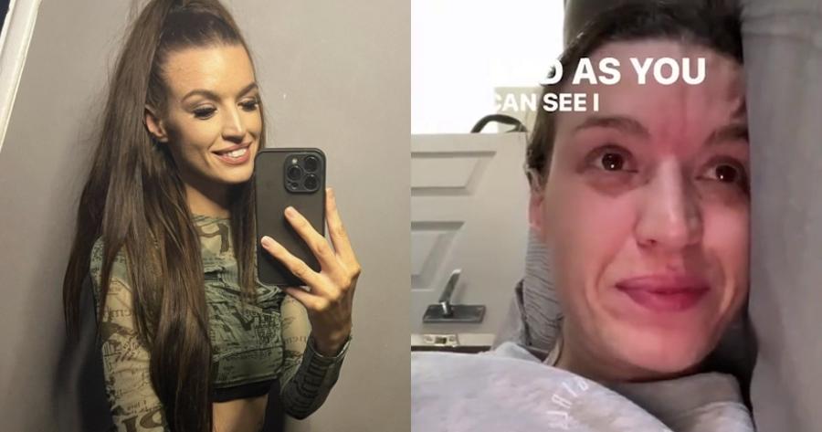 Υπέφερε για μήνες με ημικρανίες: Η 30χρονη TikToker που πέθανε μετά από χειρουργείο