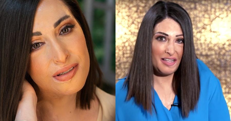 Μεγαλείο ψυχής από την Ιωάννα Παλιοσπύρου: «Δεν νιώθω μίσος και θυμό για τη γυναίκα που μου έριξε το βιτριόλι»