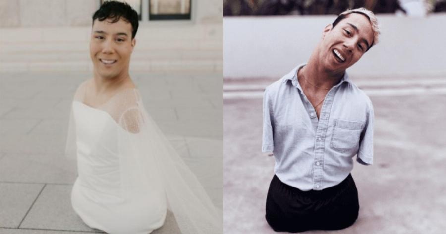 Γεννήθηκε χωρίς άκρα και εγκαταλείφθηκε, σήμερα «τσακίζει» τον αλγόριθμο του Instagram: Είναι κορυφαίος make up artist με εκατομμύρια θαυμαστές