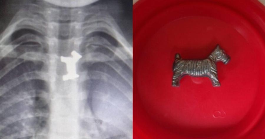 5χρονο αγόρι σώθηκε από θαύμα: Κέρδισε τη μάχη για τη ζωή, αφού κατάπιε μεταλλικό παιχνίδι