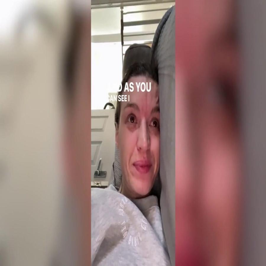 Υπέφερε για μήνες με ημικρανίες: Η 30χρονη TikToker που πέθανε μετά από χειρουργείο