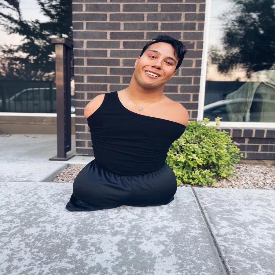 Γεννήθηκε χωρίς άκρα και εγκαταλείφθηκε, σήμερα «τσακίζει» τον αλγόριθμο του Instagram: Είναι κορυφαίος make up artist με εκατομμύρια θαυμαστές