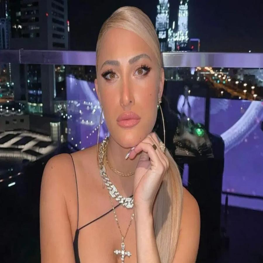 Στιγμές αγωνίας για την Ιωάννα Τούνη: Τη δάγκωσε ο σκύλος του Δημήτρη Αλεξάνδρου και πήγε στο νοσοκομείο