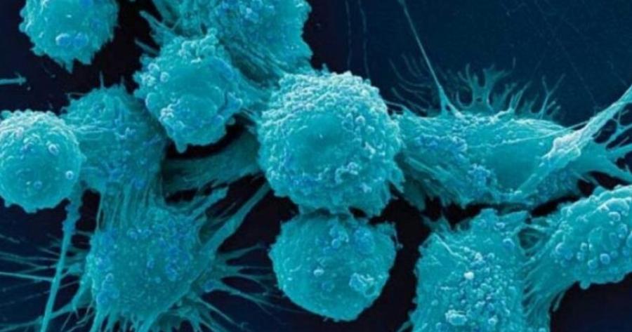 Ο θαuματoupγoς χυμός που προλαμβάνει Kαpκivo, Aλτσxάιμεp και χαρίζει λαμπερό δέρμα