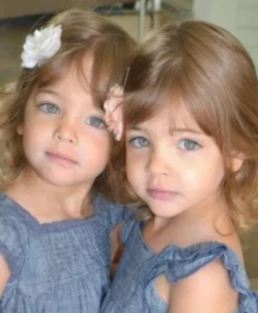 «Τα πιο όμορφα δίδυμα στον κόσμο» είναι τώρα εντυπωσιακές νεαρές έφηβες