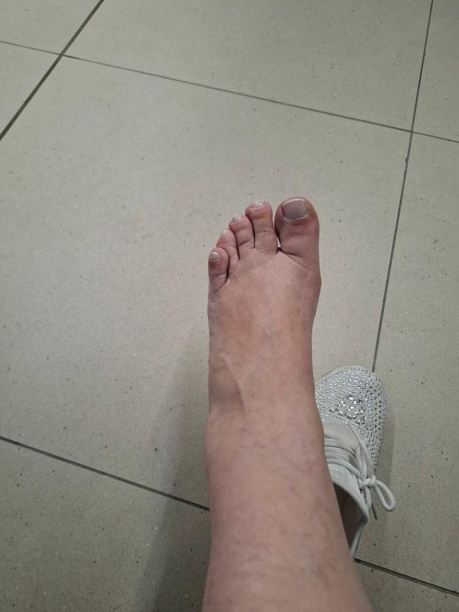 Βάσια Παναγοπούλου: Ατύχημα για την ηθοποιό στην Κωνσταντινούπολη – Οι δύσκολες ώρες μέχρι να καταλήξει στο ΚΑΤ