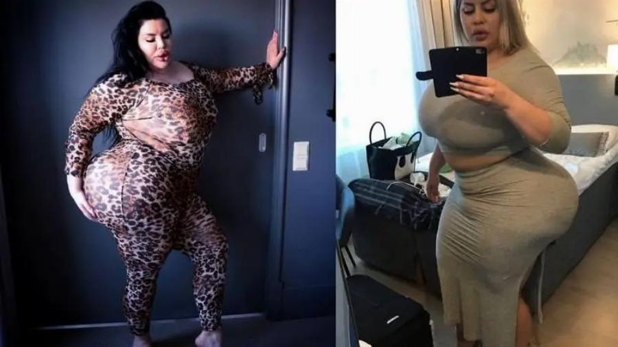 «Ξόδεψα 150.000 σε πλαστικές επεμβάσεις, αλλά δεν βρίσκω σύντροφο γιατί τρομάζω τους άντρες»