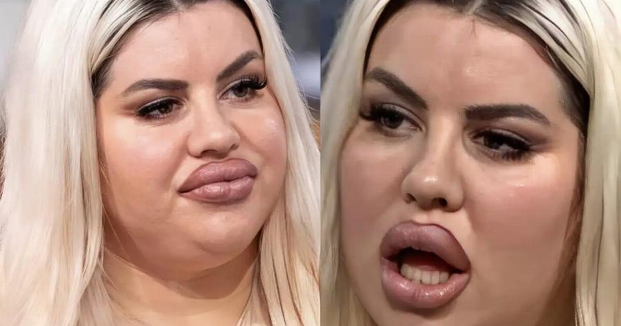 «Ξόδεψα 150.000 σε πλαστικές επεμβάσεις, αλλά δεν βρίσκω σύντροφο γιατί τρομάζω τους άντρες»