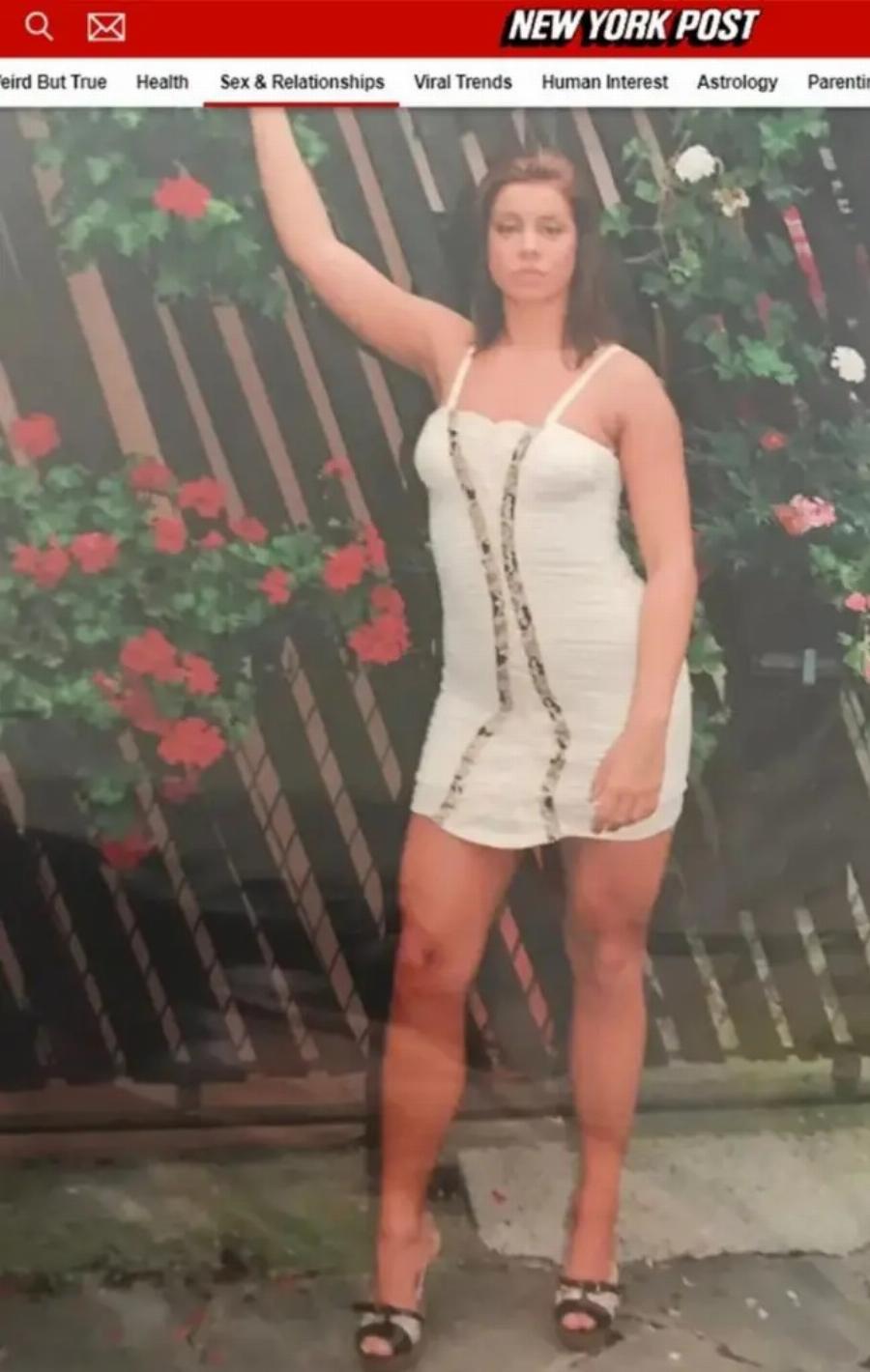 «Ξόδεψα 150.000 σε πλαστικές επεμβάσεις, αλλά δεν βρίσκω σύντροφο γιατί τρομάζω τους άντρες»