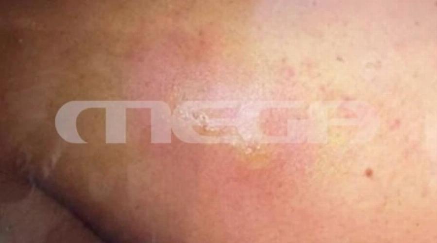 Φωτογραφία