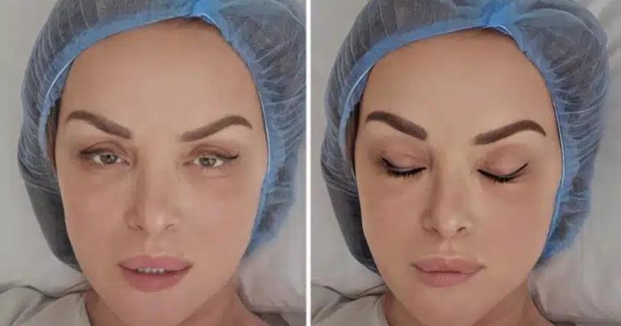 Γνωστή αγαπημένη Ελληνίδα εσπευσμένα στο χειρουργείο μετά από ατύχημα – «Ο πόνος αφόρητος»