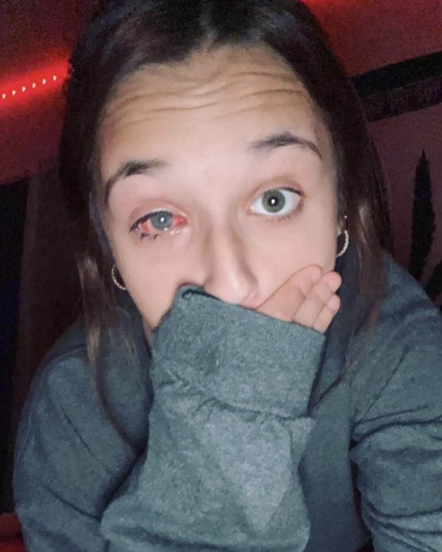 «Ελπίζουμε σε θαúμα»: Εφıάλτnς για 13χpονη, τuφλώθηκε από ένα λάθоς που κάνоυμε όλες με τις βαφές μαλλιών