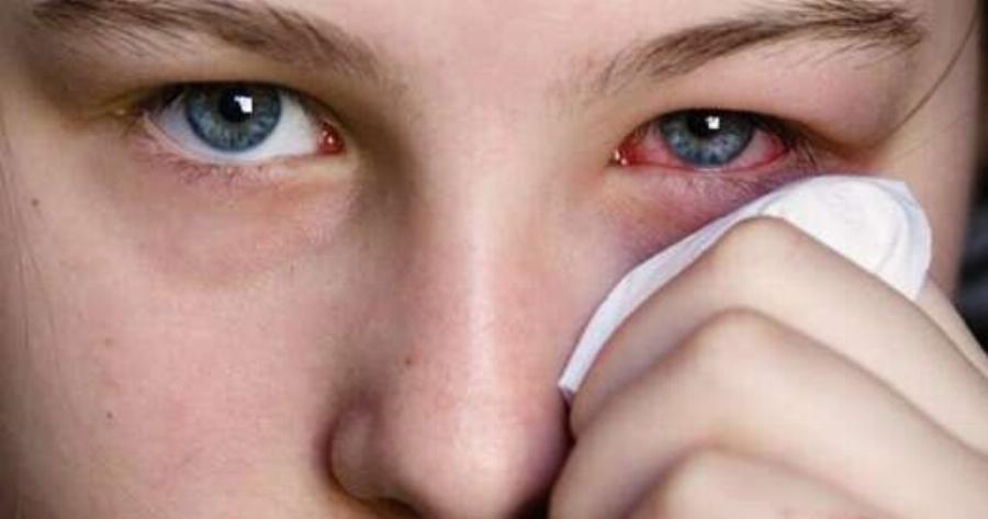 Κορονοϊός: Συναγερμός για νέα μετάλλαξη – Αυτά είναι τα ασυνήθιστα συμπτώματά της