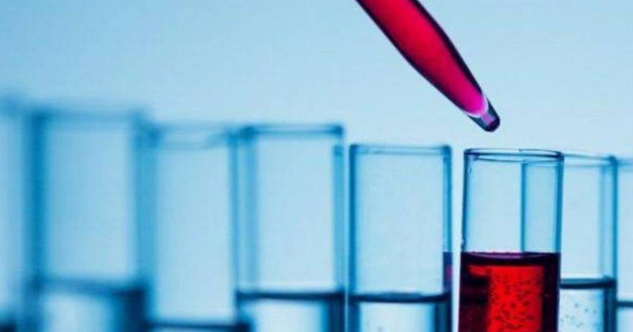 Εξετάσεις αίματος: Να τι σημαίνει κάθε εξέταση στη γενική αίματος και τι να κοιτάς