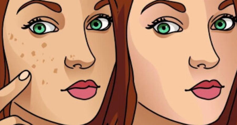 Λεύκανση επιδερμίδας: Πως να λευκάνετε φυσικά το δέρμα σας και να αντιμετωπίσετε τα σημάδια της γήρανσης