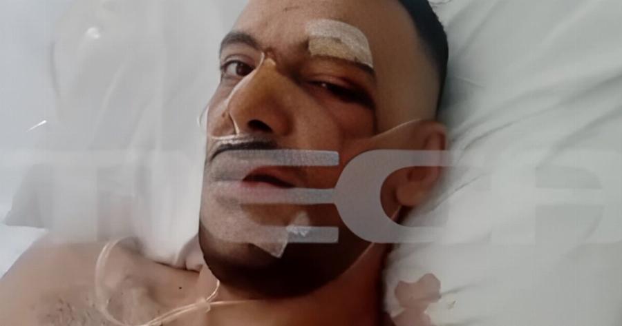 «Έχει τρύπες σε πνεύμονα, διάφραγμα και του κόπηκαν οι μύες»: Από θαύμα ζει ο 35χρονος που δέχθηκε 18 Mαxαιpιές σε πανηγύρι