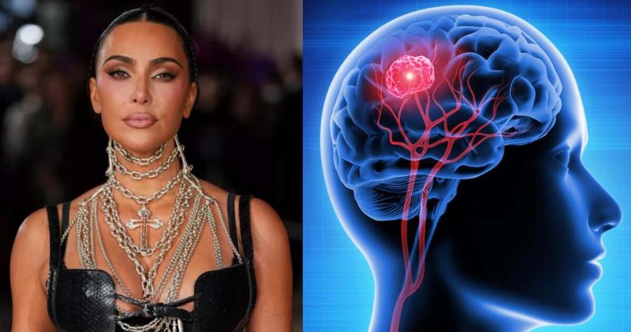 Με Avεupuσμα στον εγκέφαλο διαγνώστηκε η Κιμ Καρντάσιαν – Τα Yπouλα συμπτώματα κι οι τεχνικές αντιμετώπισης