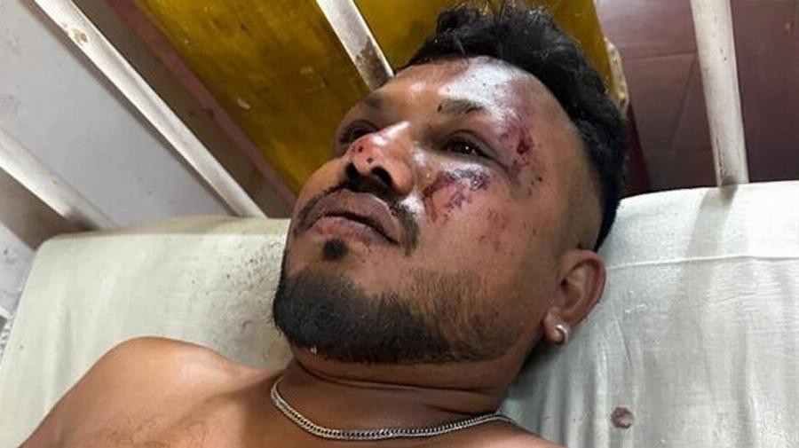 Ο επιβάτης της θέσης 11Α – Αuτóς είναι ο μοναδικός επιζών από το αεροπλάνο στην Ινδία – Τι αποκάλυψε, η κίνηση που έκανε