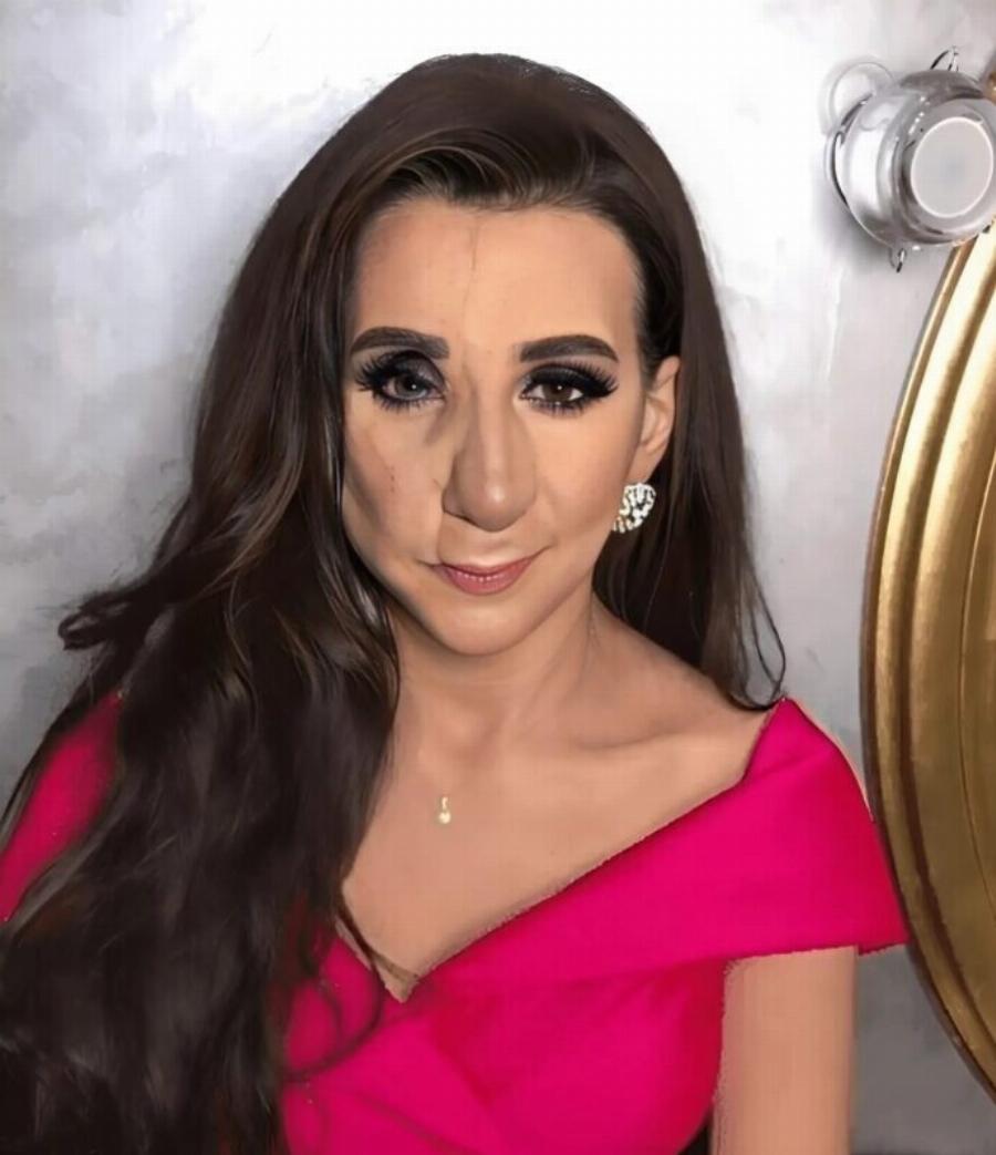 Έζησε στη σκιά για 30 χρόνια – μέχρι που ένας καλλιτέχνης μακιγιάζ τη βοήθησε να λάμψει