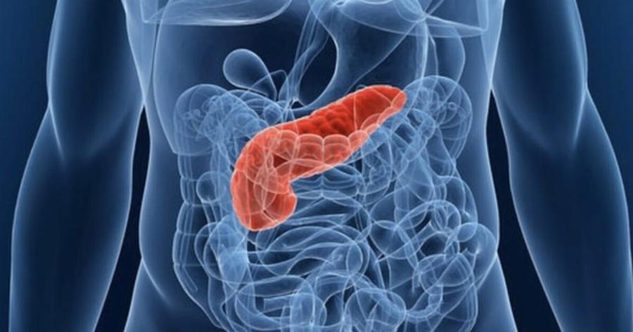 Καρκίνος στο Πάγκρεας: Δύο πρώιμα σημάδια ενός συχνά θανατηφόρου καρκίνου