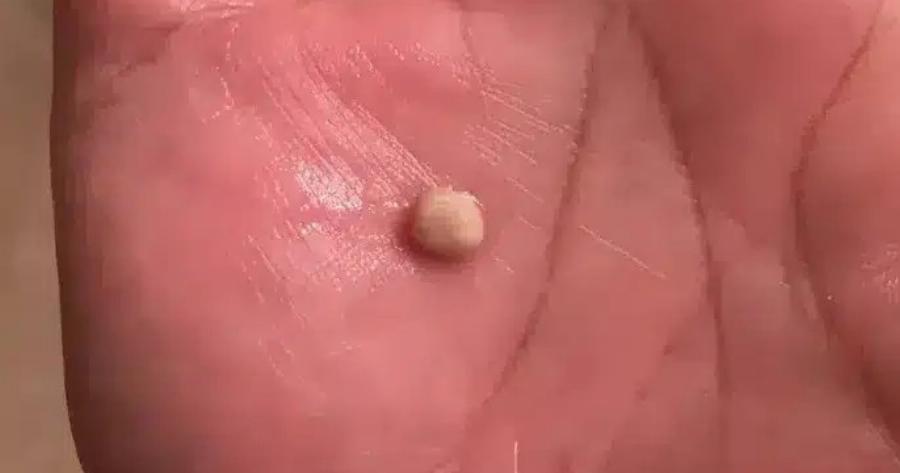 Να τι πρέπει να γνωρίζετε για αυτές τις πέτρες – Που εμφανίζονται