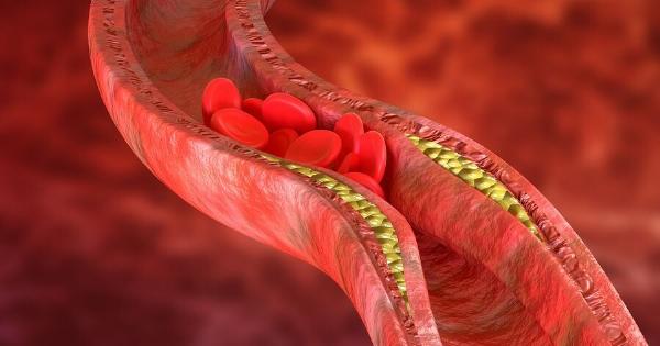 Ποια δίαιτα «ξεβουλώνει» τις αρτηρίες