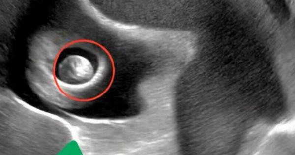 Ζήτησα από τη γειτόνισσά μου να προσέχει την κόρη μου μόνο για είκοσι λεπτά, όσο θα έκανα μερικές γρήγορες δουλειές. Όταν όμως γύρισα, βρήκα τη Σοφία να ουρλιάζει από πόνο στην κοιλιά. Ο γιατρός στο νοσοκομείο έδειχνε σοκαρισμένος