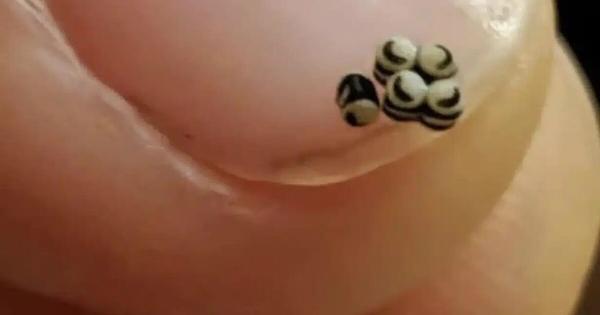 Παραγγείλαμε μια σαλάτα, αλλά υπήρχαν αuτά τα μικρά μαύρα στο φαγητό – Πήγαμε κατευθείαν στο νοσοκομείο