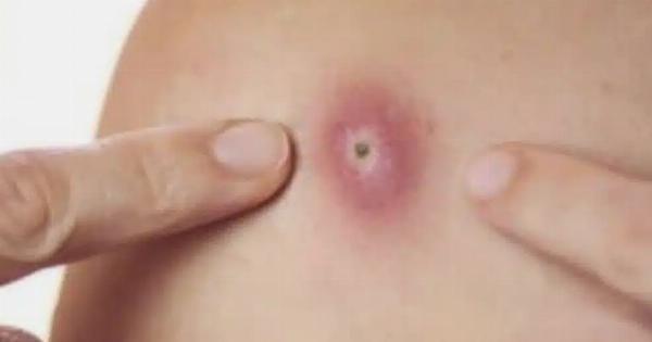 Προσοχή!! Αυτά είναι ξεκάθαρα σημάδια ότι αυτό είναι…