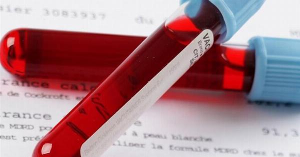 Πότε η γενική αίματoς δείχνει καρκίνο