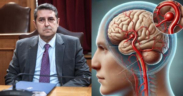 Τι είναι το εγκεφαλικό ανεύρυσμα που έπαθε ο Γιώργος Μυλωνάκης: Τα συμπτώματα και οι κίνδυνοι