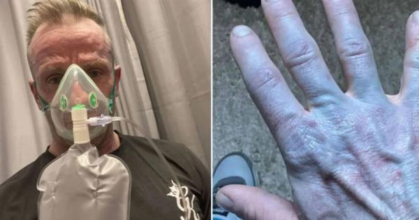 Σοκαριστικό περιστατικό σε νοσοκομείο! “Θεέ μου, συγγνώμη” – Οι γιατροί “πάγωσαν” – Ήταν όλος μπλε και…