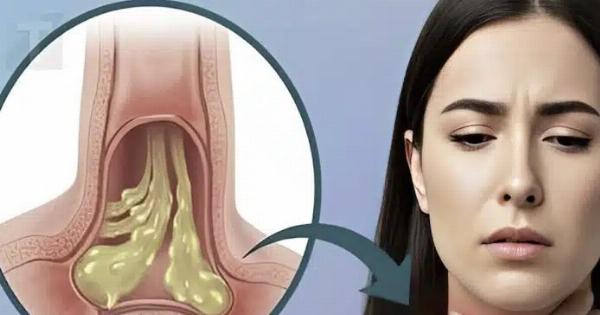 Πώς να ανακουφίσετε και να μειώσετε αποτελεσματικά και με ασφάλεια τα φλέγματα στον λαιμό