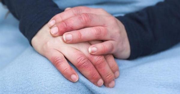 Οι γιατροί προειδοποιούν ότι αν έχετε συχνά κρύα χέρια τότε…