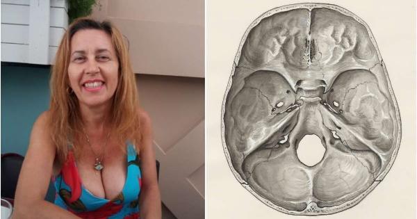 Πέθανε από εγκεφαλικό η καθηγήτρια Σοφία Χρηστίδου: Τα 6 προειδοποιητικά σημάδια που σώζουν ζωές