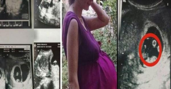 Όταν οι γιατροί είδαν το υπερηχογράφημα 36χρονης εγκύου φοβήθηκαν να την αγγίξουν – Δεν είχαν αντιμετωπίσει ποτέ κάτι παρόμοιο