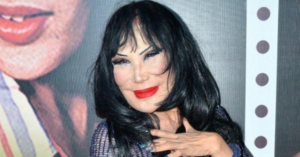 Ήταν γνωστή για την εντυπωσιακή φυσική ομορφιά της — και μόλις τη δείτε πριν από την επέμβαση, θα καταλάβετε γιατί