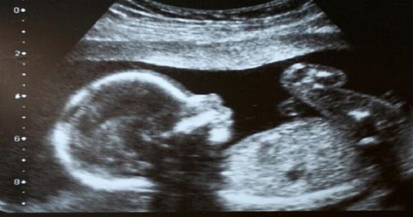 Έγκυος είδε στον υπέρηχο το μωρό της και την έλουσε κρύος ιδρώτας …