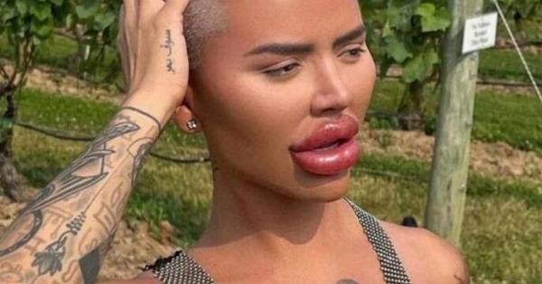 Όλος ο κόσμος έμεινε άφωνος όταν ο μη συνηθισμένος τύπος με τις πολλαπλές επεμβάσεις μοιράστηκε τις φωτογραφίες του αρχείου του